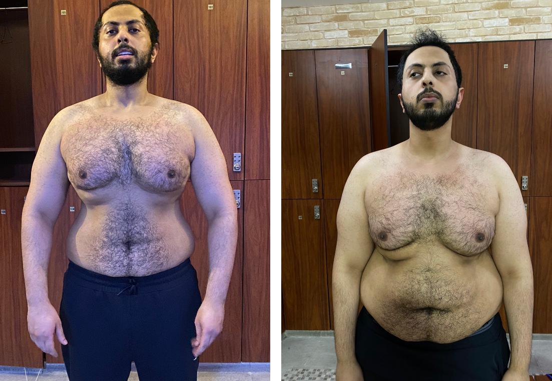 Weight loss transformation — before and after