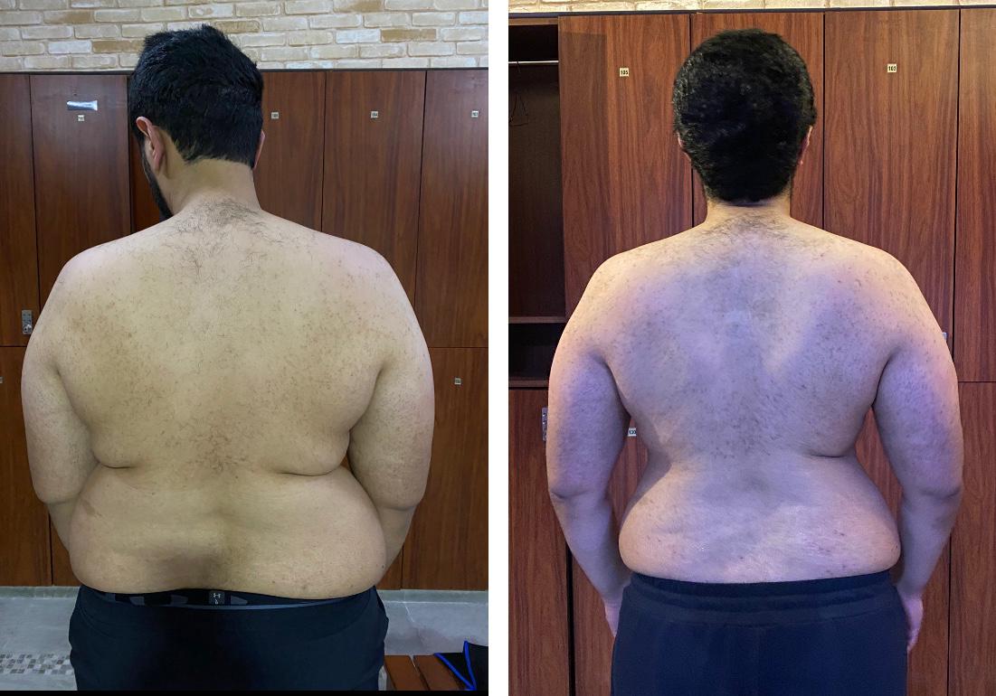 Muscle gain transformation — back, before and after
